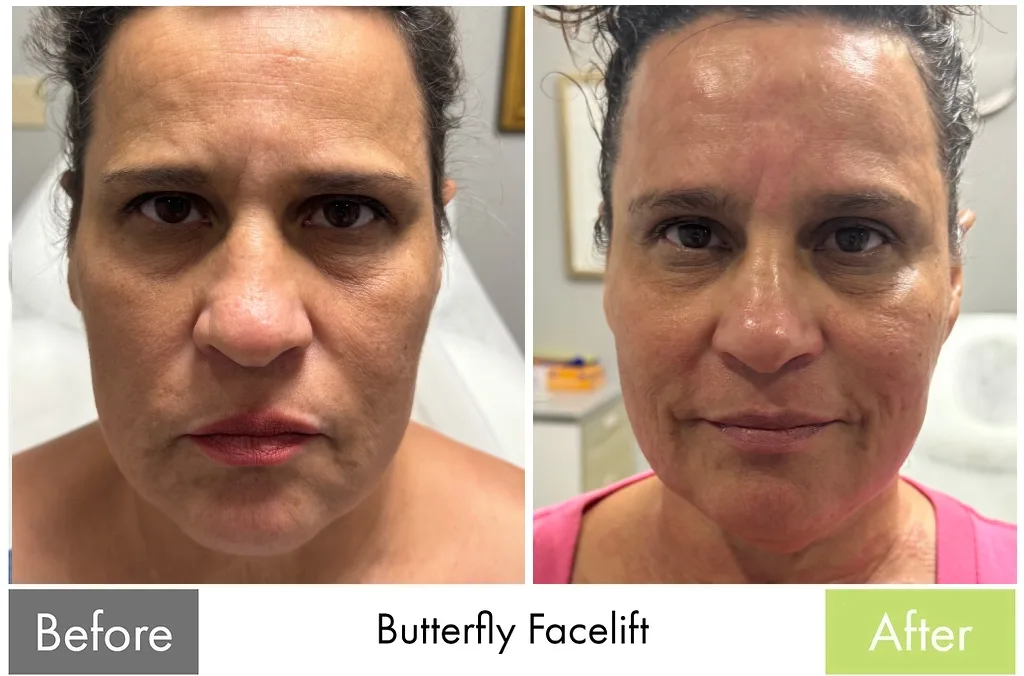 Before and after — Total transformation in a single session