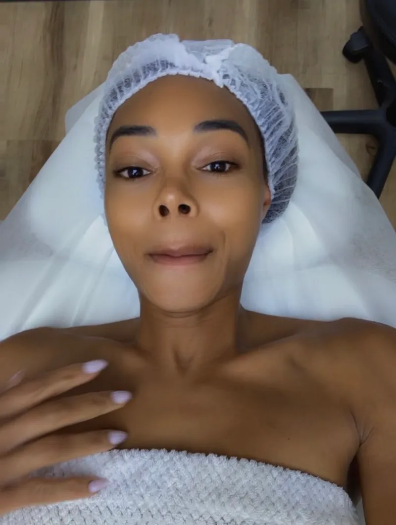 jasmine davis during her skin treatment at Newport Beach Skin Tightening, photo she attached to her Google review