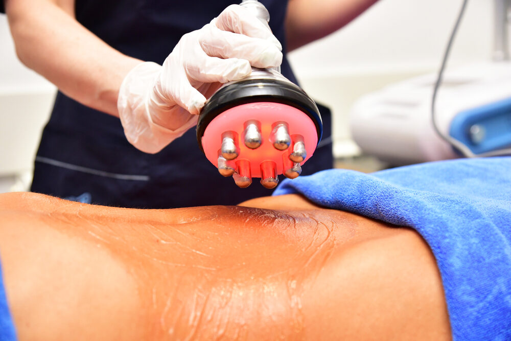 Rf,Skin,Tightening,,Belly.,Hardware,Cosmetology.,Body,Care.,Non,Surgical