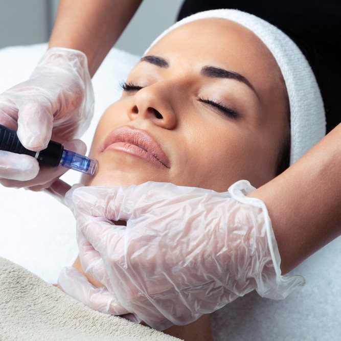 Micro-Needling